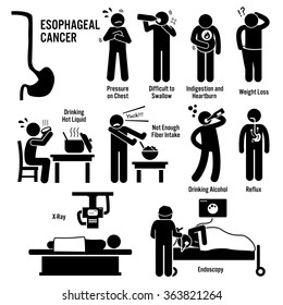 Esophageal Esophagus Throat Cancer Symptoms Causes Stock Illustration