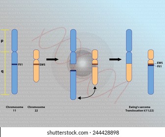 Ewing's Sarcoma Chromosomal Translocation