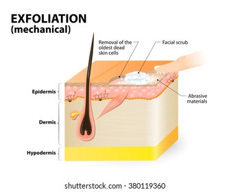 Exfoliation. Mechanical Means. Cosmetology. Cross-section Of A Skin Layers. 