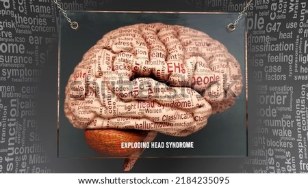 Exploding head syndrome anatomy - its causes and effects projected on a human brain revealing Exploding head syndrome complexity and relation to human mind. Concept art, 3d illustration