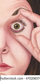 Eye - Held Open. 