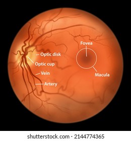 Eye retina, ophthalmoscope view, scientific illustration showing optic disk, blood vessels, macula and fovea. Labelled version of the image