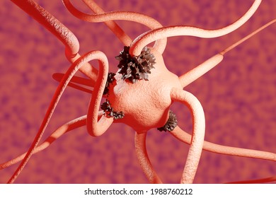 Fading of the functions of brain neurons in Parkinson's disease. Synapses of neurons affected by Altsheimer's disease. 3d rendering - Powered by Shutterstock