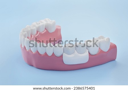 false teeth at below molar tooth, blue background, 3D rendering.