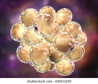 Fat Cells. 3D Illustration Showing Presence Of Big Lipid Droplet (yellow) Inside The Cell. The Violet Structure Is Nucleus