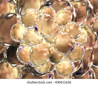 Fat Cells. 3D Illustration Showing Presence Of Big Lipid Droplet (yellow) Inside The Cell. The Violet Structure Is Nucleus