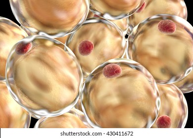 Fat Cells. 3D Illustration Showing Presence Of Big Lipid Droplet (yellow) Inside The Cell. The Red Structure Is Nucleus