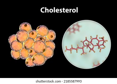 Fat Cells, Adiposes Cell, Adipocytes. 3D Illustration Showing Presence Of Big Lipid Droplet Yellow Inside The Cell. The Violet Structure Is Nucleus