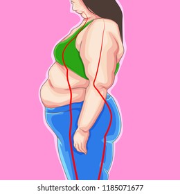 Fat girl. Loss weight on diet or sport. Before picture. Weight loss concept.  illustration