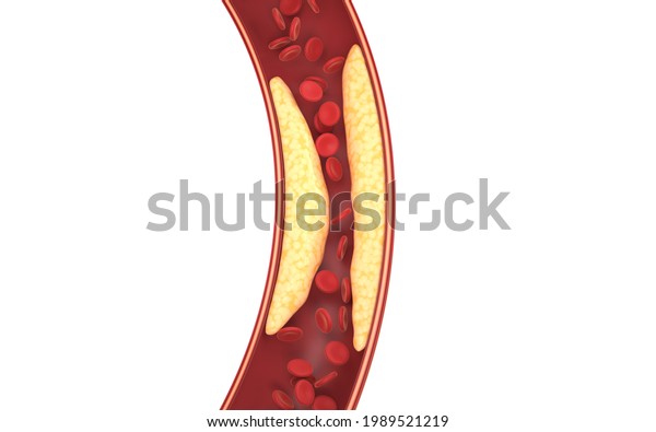 Fat Red Blood Cells Blood Vessels Stock Illustration 1989521219 ...