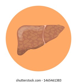 Fatty Liver Disease. Sick Internal Organ. Idea Of Healthcare And Bad Nutrition. Biology Concept. Isolated Flat  Illustration