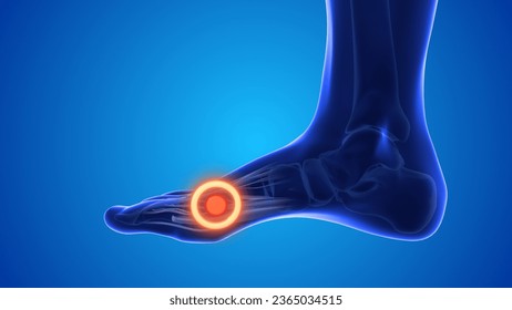 Feet acupressure point for cure water retention in body 3D Illustration - Powered by Shutterstock