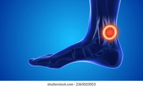 Feet acupressure point to relieve ankle and heel pain 3D Illustration - Powered by Shutterstock