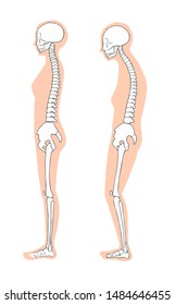 Female Correct Bad Skeleton Stock Illustration 1484646455 | Shutterstock