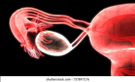 1,053 3d medical illustration ovarian cancer Images, Stock Photos ...