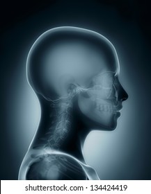 Female Skull Medical X-ray Scan