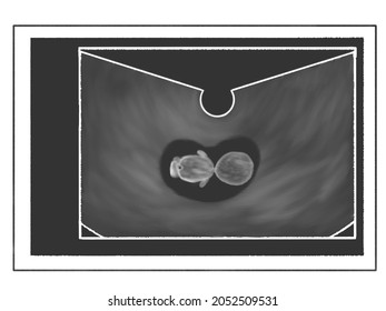 Fetal Ultrasound Scan; 12 Weeks Pregnant