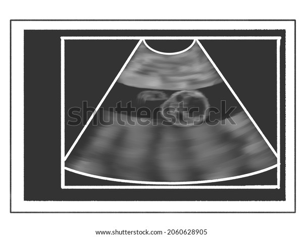 Fetal Ultrasound Scan 16 Weeks Pregnant Stock Illustration 2060628905 Shutterstock 