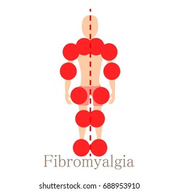 Fibromyalgia Icon. Cartoon Illustration Of Fibromyalgia  Icon For Web Isolated On White Background