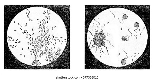 Fig 2. A bacterium (Bacterium termo), Fig 3. monads (Monas lens) Uvelles (Uvella Socialis), magnified 500 times, vintage engraved illustration. Magasin Pittoresque 1873.