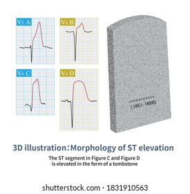 st elevation tombstone