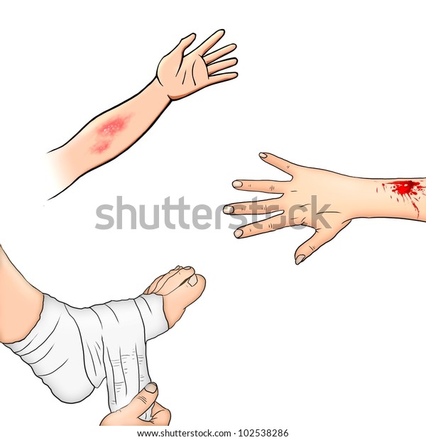 First Aid Injuries Illustration Stock Illustration 102538286