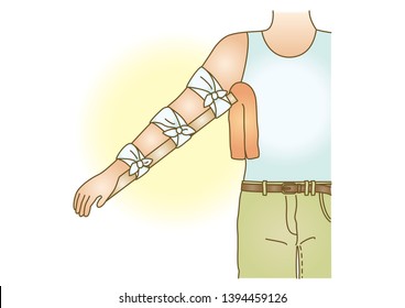 Open Fracture Images, Stock Photos & Vectors | Shutterstock