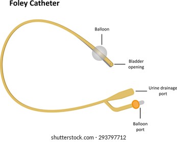 Foley Indwelling Catheter