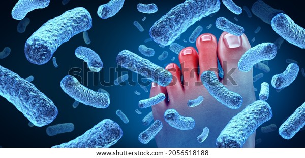 Foot Bacteria Disease Toes Bacterial Infection Stock Illustration ...