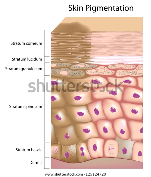 Formation of uneven skin\
tone