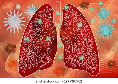 Fractal model of damage to a human lung organ by an abstract 3D covid19 virus. The concept of a coronavirus pandemic