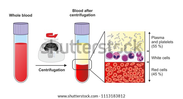 Fractionating or\
separating whole blood by centrifuging the resulting components are\
plasma with platelets, a layer of leukocytes or buffy coat and\
erythrocytes at the bottom of the tube.\
