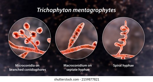 Fungi Trichophyton mentagrophytes, 3D illustration showing branched conidiophores bearing spherical microconidia, macroconidium, septate and spiral hyphae. Causes ringworm, hair and nail infections