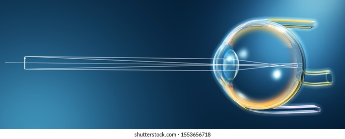 Futuristic 3D illustration showing human eye with pupil, iris, anterior chamber, posterior chamber, ciliary body, eye ball and vitreous body