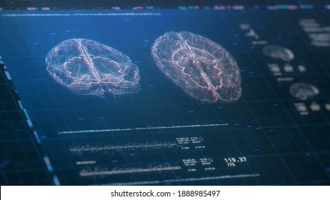 Futuristic Brain Scanning Illustartion. Neurology Data, Vital Signs On Display. MRI Device. Future Technology. Diagnosis Of Diseases. 3D HUD Or Interface. Digital Cyber Concept. Depth Of Field Effect.