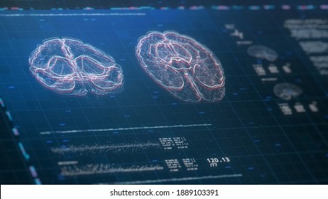 Futuristic Brain Scanning Illustartion. Neurology Data, Vital Signs On Display. MRI Device. Future Technology. Diagnosis Of Diseases. HUD Or Interface. Digital Cyber 3D Concept. Depth Of Field Effect.