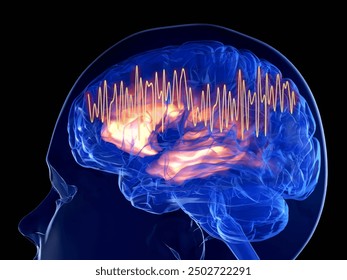 Gamma waves are associated with higher brain functions like working memory, attention, and perceptual grouping. Patient's of Alzheimer's disease show lagged gamma responses.