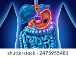 Gastric Cancer or stomach tumor in the digestive system as a medical and gastrointestinal disease with painful belly symptoms as a medicine concept with 3D illustration elements.