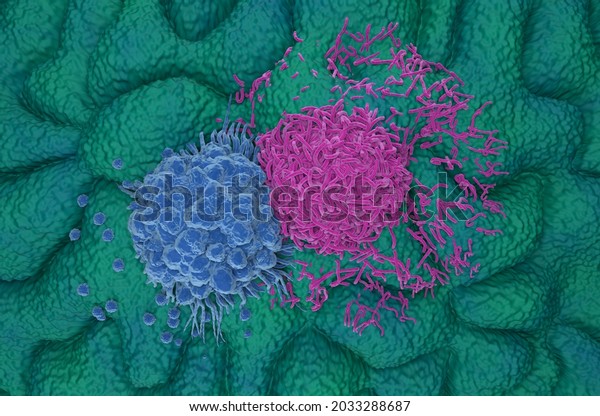 Gastric\
stomach cancer cells top view 3d\
illustration
