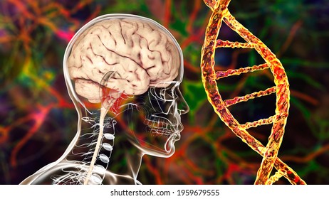 Genetic brain disorders, conceptual 3D illustration. Mutations in the DNA leading to brain diseases. Neurogenetics, neurodegenerative disorders