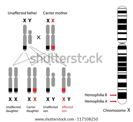 Genetics Hemophilia B Stok İllüstrasyonu 117108250 - Shutterstock