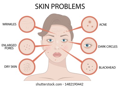 14,036 Eczema treatment Images, Stock Photos & Vectors | Shutterstock