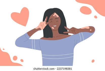 Girl with skin problems vitiligo illustration. Cartoon young happy woman character with depigmentation patches smiling, beautiful body positive model waving. International vitiligo day concept - Powered by Shutterstock