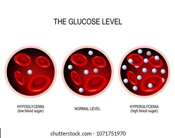 57,097 Diabetic blood Images, Stock Photos & Vectors | Shutterstock