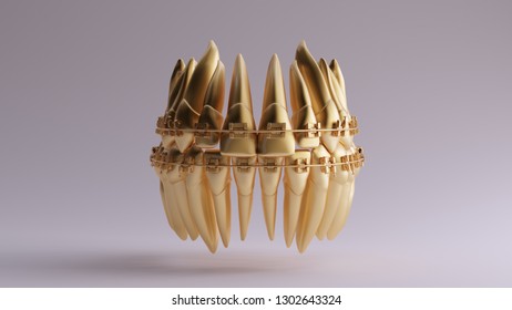 Gold Teeth With Dental Braces 3d Illustration 3d Render