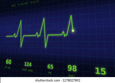 A graph of normal heartbeat on a blue monitor