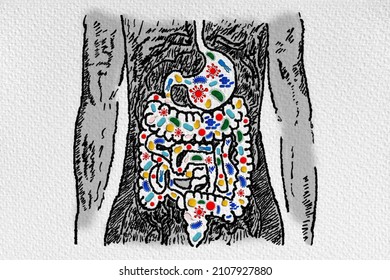 Gut Microbiome and Probiotics - Association with Gastrointestinal Diseases - Leaky Gut and Dysbiosis - Small Intestinal Bacterial Overgrowth - Conceptual Illustration 