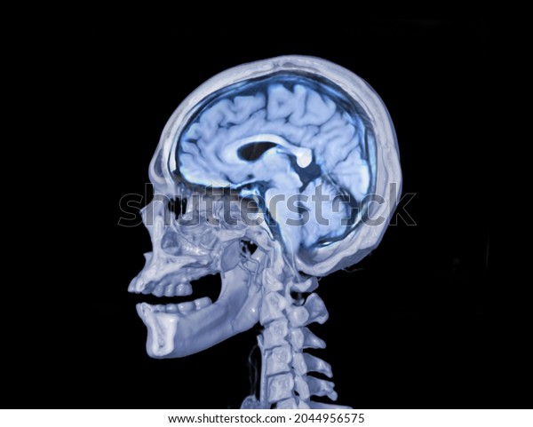 Haft Skull 3d Showing Brain Inside Stock Illustration 2044956575 ...