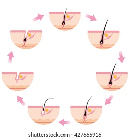 Hair Growth Cycle