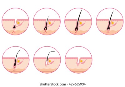 Hair Growth Cycle